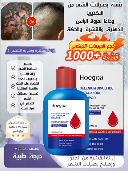 【التخلص من سعفة فروة الرأس العنيدة في 3 أسابيع】شامبو طبي مضاد للبكتيريا والعث